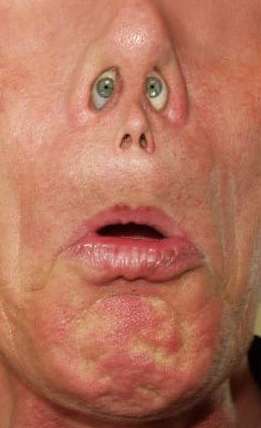 Funny Pictures of Eyes in Guys Nostrils