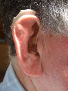 picture of hearing aid