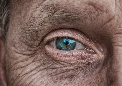 Where Do Wrinkles Come From?