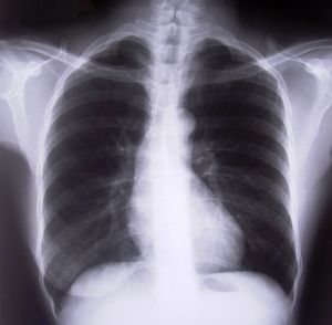 picture of an xray