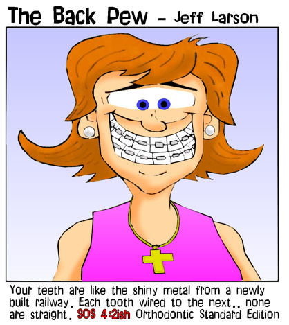 Braces - song of solomon teeth