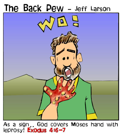 Moses Leper Hand