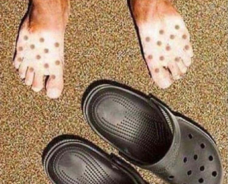 crocs that look like feet